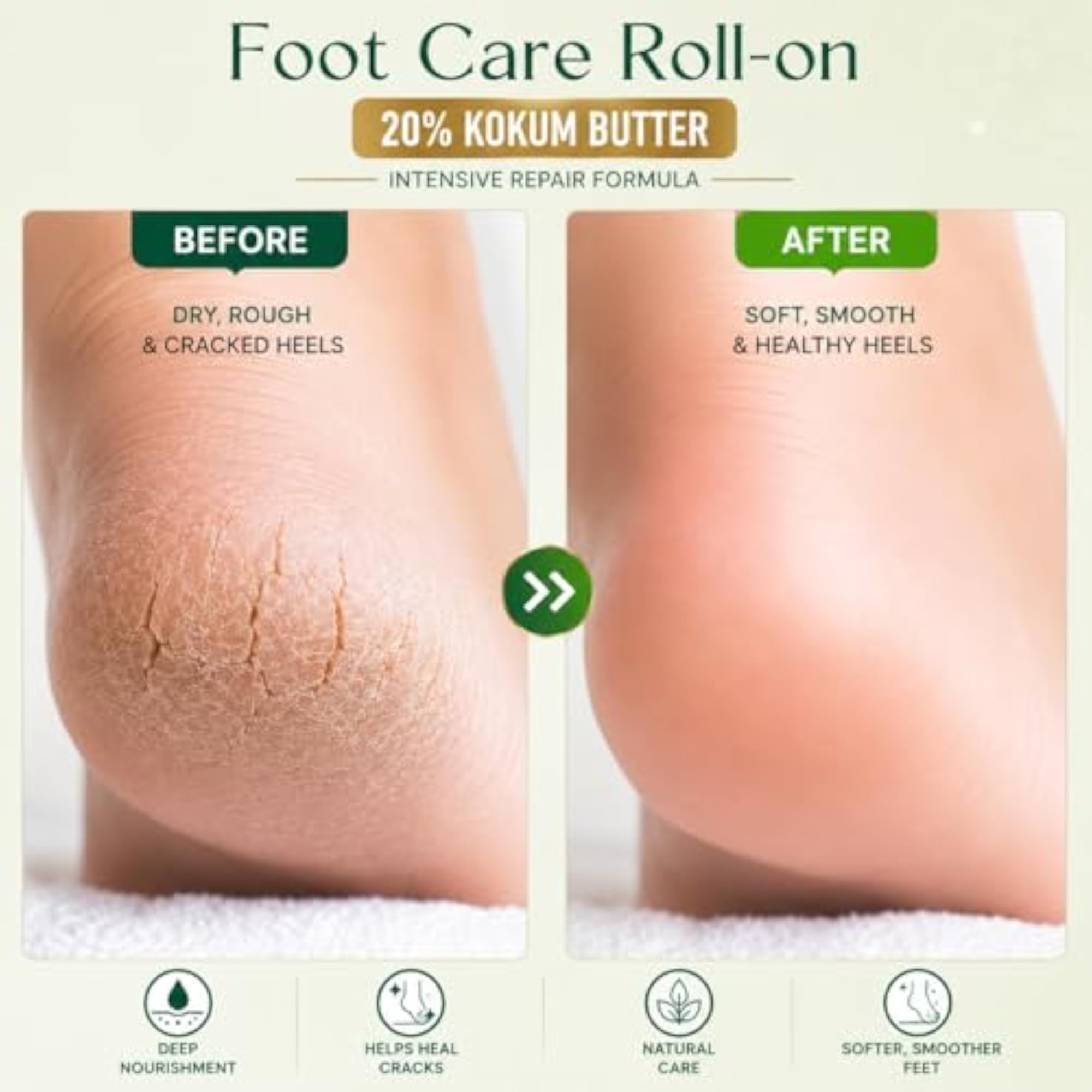 Foot Care Roll-On Cream with 20% Kokum Butter, 50ml